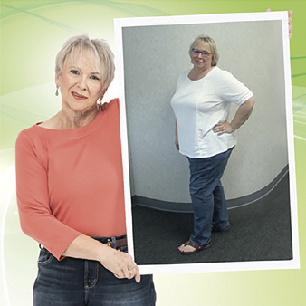 Before-and-after weight loss photos of an older woman